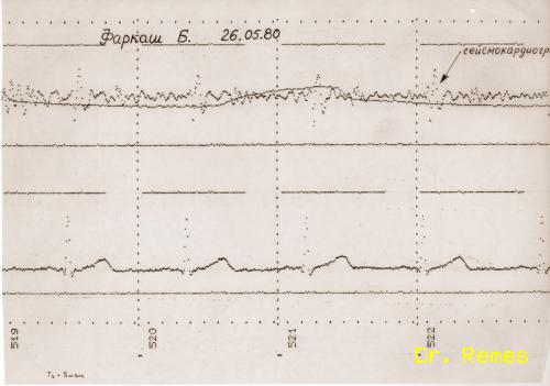 Farkas Bertalan telemetrikus úton továbbított EKG-ja, légzés görbéje, és szeizmokardiogramja a pályára álláskor - forrás: Dr. Remes